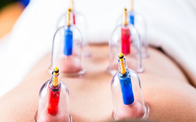 انجام "حجامت" علت بیشترین مراجعه مردم به سلامتکده‌های طب سنتی/ چرا باید متخصص طب سنتی داشته باشیم؟